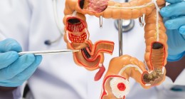 Kolorektal Kanser Farkındalığı 